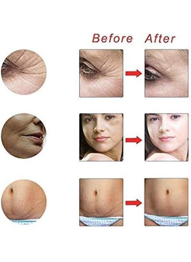 Derma roller system 3 in 1 Derma Roller System  - Image 5