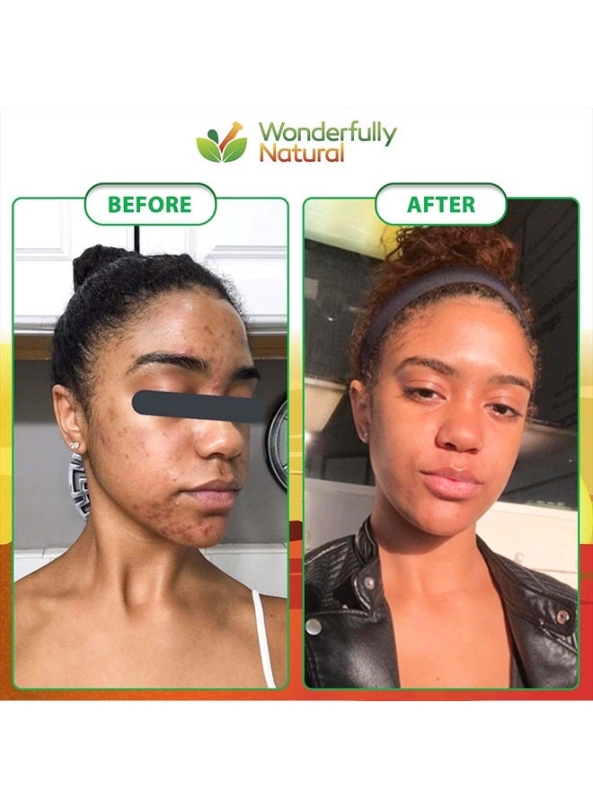wonderfully natural Organic African Black Soap - For Acne & Dark Spots | Natural Vegan and Cruelty Free – Satisfaction Guarantee 1lb bar | 90 day Supply  - Image 2