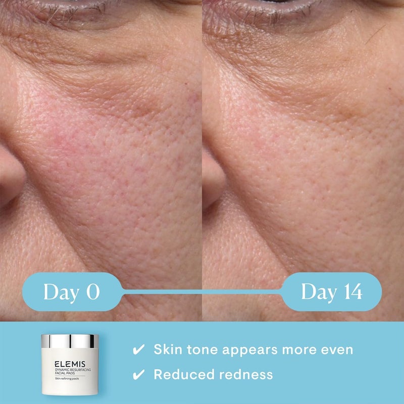 Elemis Dynamic Resurfacing Facial Pads 60 Pads | AHA Lactic Acid Exfoliating & Resurfacing Facial Pads for Smooth Bright Skin | Visibly Refines Pores, Evens Skin Tone & Reduces Dullness | Anti-Aging Daily Chemical Exfoliant Peel Pads - Image 3