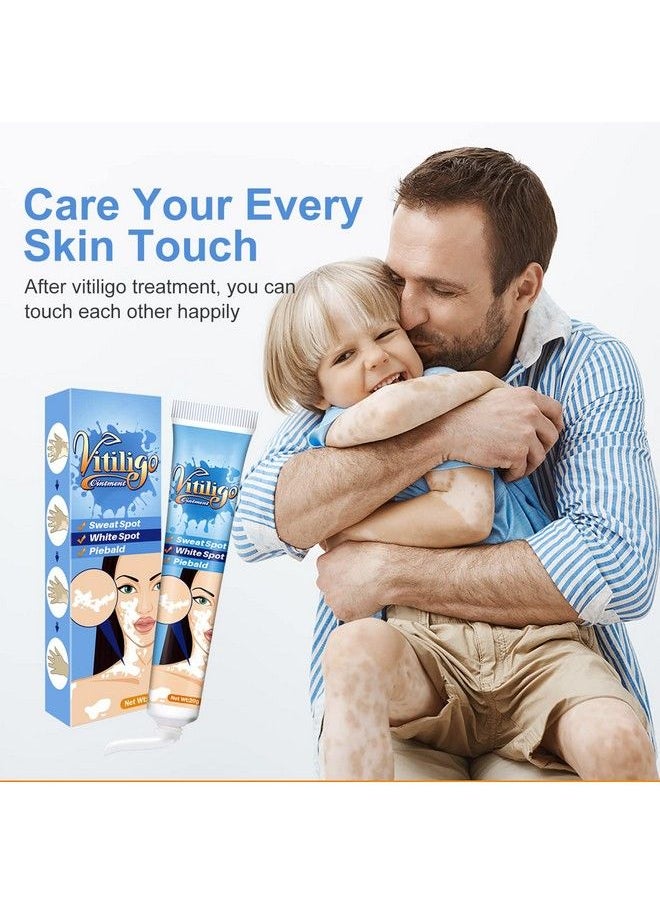 Xshows - Vitiligo Cream Vitiligo Treatment For Reduce White Spots And Improve Skin Pigmentation - Image 1