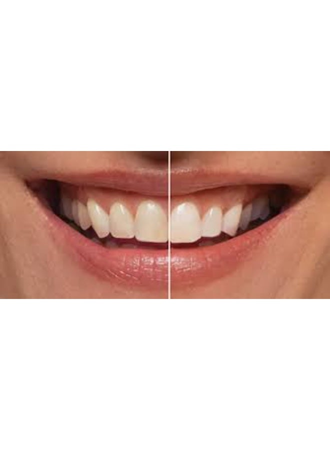 LEBON Electric toothbrush Summer Sand 1 piece - Image 3
