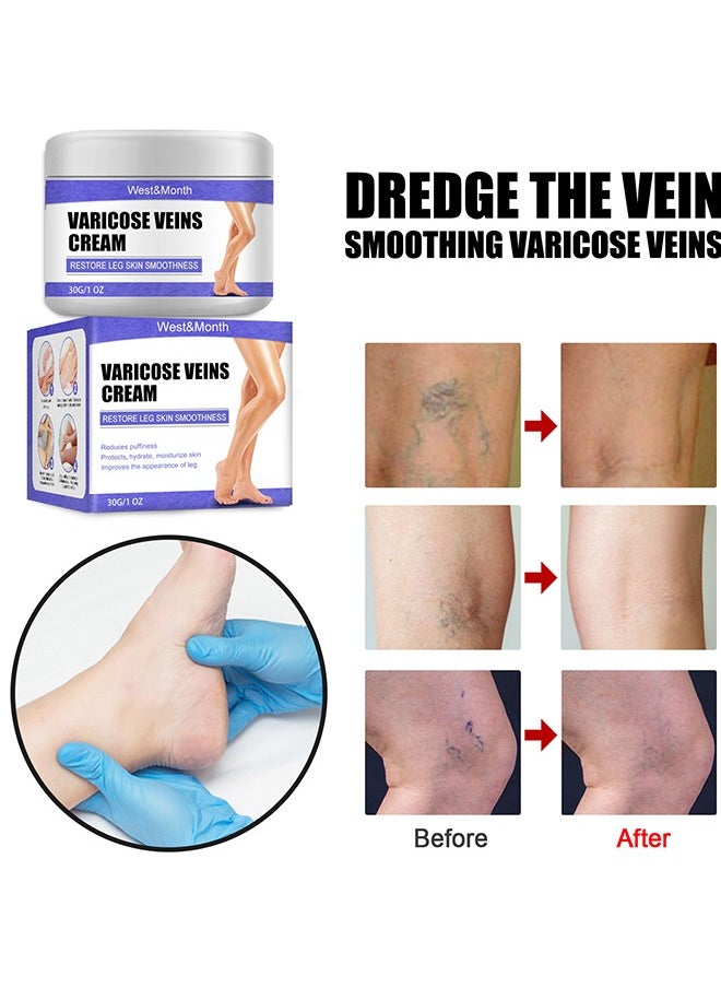 West&Month - Varicose Veins Cream - Eliminate And Spider Veins, Varicose Veins Relief Cream, Improve Blood Circulation, Soothes Tired Legs - Image 1