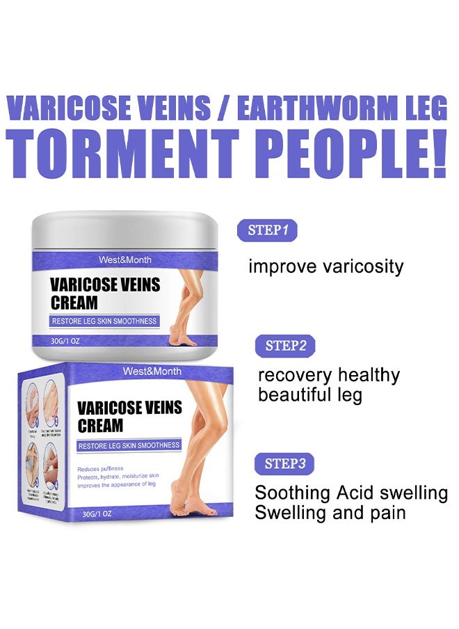 West&Month - Varicose Veins Cream - Eliminate And Spider Veins, Varicose Veins Relief Cream, Improve Blood Circulation, Soothes Tired Legs - Image 1