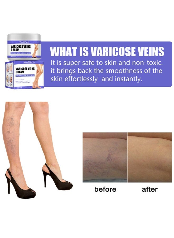 West&Month - Varicose Veins Cream - Eliminate And Spider Veins, Varicose Veins Relief Cream, Improve Blood Circulation, Soothes Tired Legs - Image 1