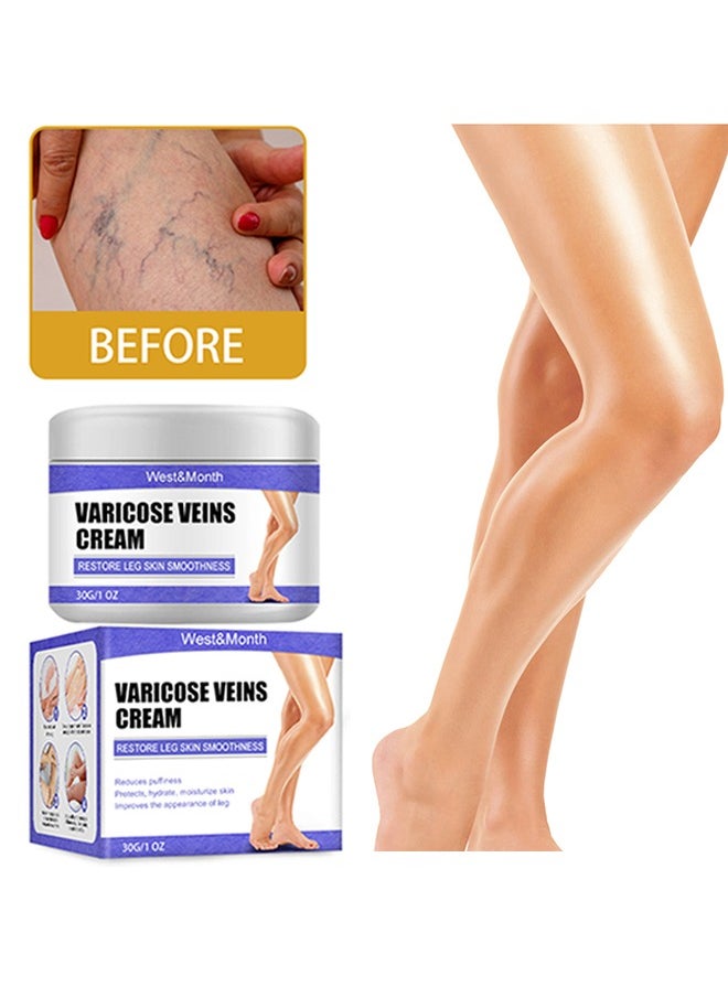 West&Month - Varicose Veins Cream - Eliminate And Spider Veins, Varicose Veins Relief Cream, Improve Blood Circulation, Soothes Tired Legs - Image 1