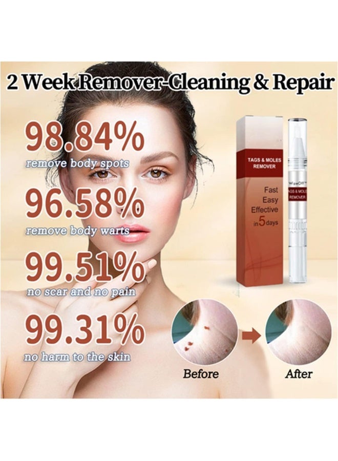 Wipe Off Tags and Mole Remover, Wipeoff Tags & Moles Remover Fast Easy Effective in 5 Days, Extreme Skin Tag Wipe Off Tags & Mole Remover, for All Body Parts (3PC) - Image 2