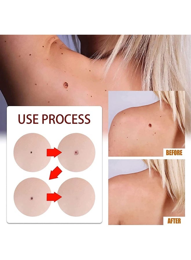 Wipe Off Tags and Mole Remover, Wipeoff Tags & Moles Remover Fast Easy Effective in 5 Days, Extreme Skin Tag Wipe Off Tags & Mole Remover, for All Body Parts (3PC) - Image 3