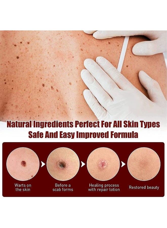 Wipe Off Tags and Mole Remover, Wipeoff Tags & Moles Remover Fast Easy Effective in 5 Days, Extreme Skin Tag Wipe Off Tags & Mole Remover, for All Body Parts (3PC) - Image 5