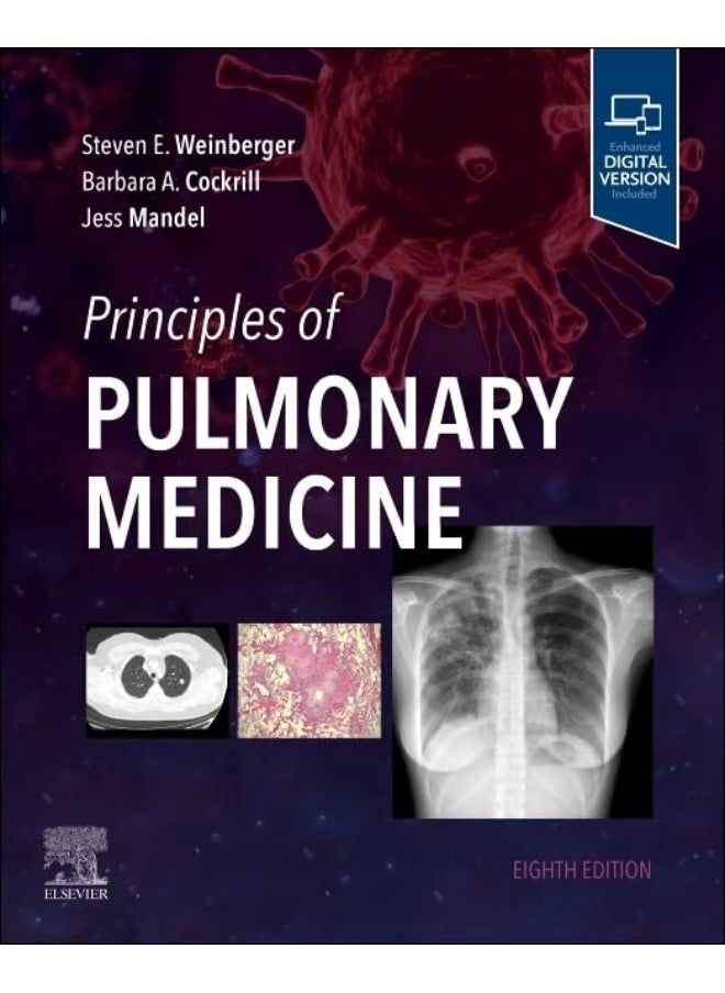 Principles of Pulmonary Medicine 