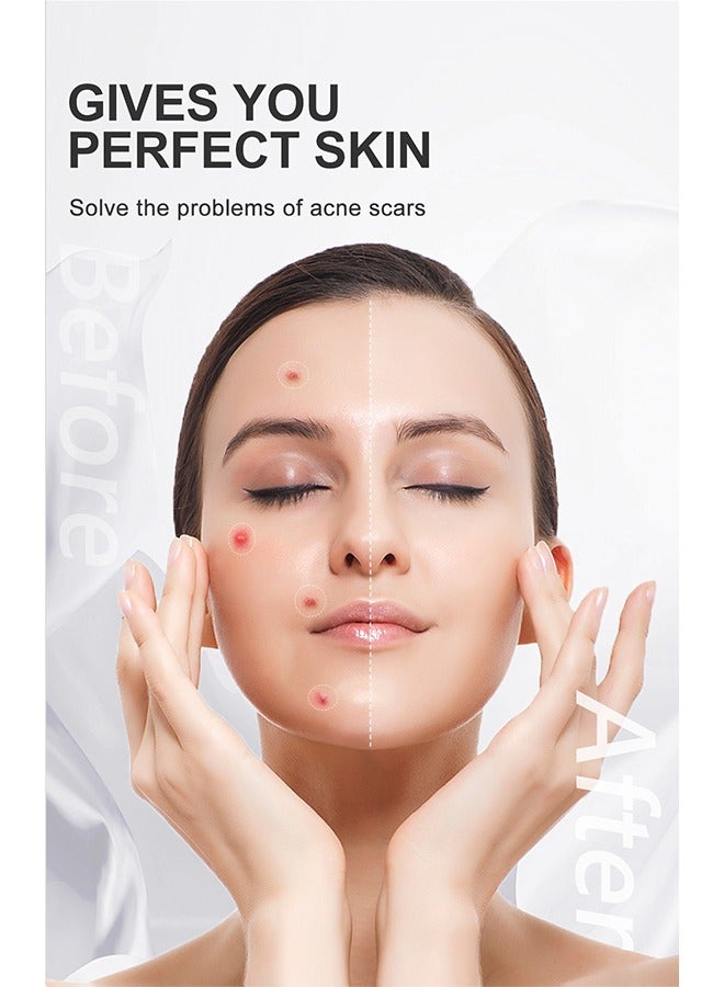 آر توب آر مانجو ريبير كريم حب الشباب شفاف 15 جرام - Image 2