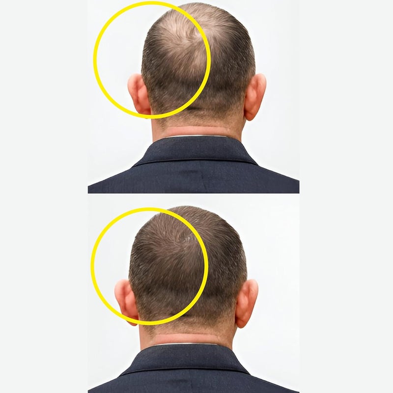 Masofta Hair Growth Serum For Promoting Hair Growth  Controlling Hair Fall  With 3 Redensyl 5 Capixyl 4 Anagain 3 Procapil  3 Baicapil Rosemary  Biotin For Both Men  Women 30ML - Image 2