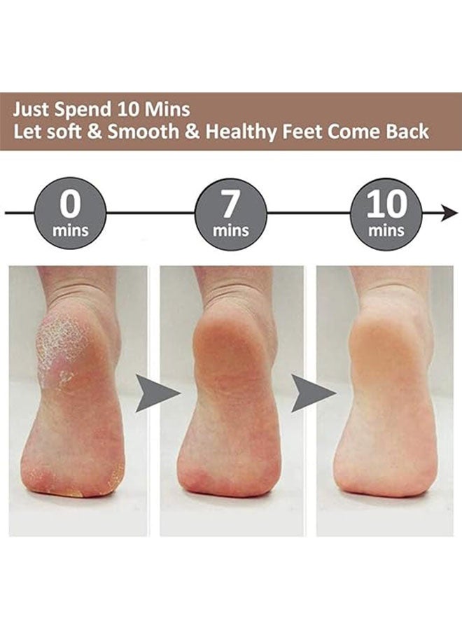 Electric Foot Grinder Callus Remover, Smooth Pedicure Tools for Removing Dead Skin and Calluses, Foot Care - Image 5