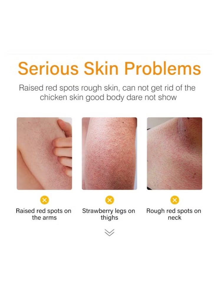 موويام علاج الساقين بالفراولة للنساء، كريم ترطيب الجسم من الفراولة، كريم ترطيب الجسم من التقرن الجاف، مرطب الجسم لتفتيح المناطق الجافة - Image 3