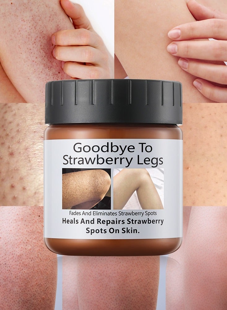 MOOYAM Dark Spot Corrector for Strawberry Legs, Moisturizing Whitening Brightening Cream, Fades And Eliminates Strawberry Spots, Heals And Repairs Strawberry Spots On Skin, Dark Spot Treatment Removal Remover Corrector for Arm Neck Legs Skin Care Treatment 120g - Image 1