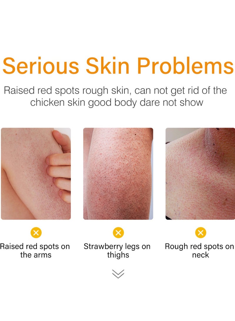 MOOYAM Dark Spot Corrector for Strawberry Legs, Moisturizing Whitening Brightening Cream, Fades And Eliminates Strawberry Spots, Heals And Repairs Strawberry Spots On Skin, Dark Spot Treatment Removal Remover Corrector for Arm Neck Legs Skin Care Treatment 120g - Image 3