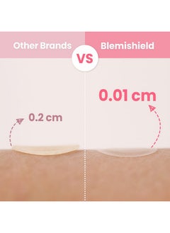 Glam Up Hydrocolloid Blemish Pimple Zit Patches(180Pcs/2Size) Invisible Ultra Thin Spot Cover Stickers For Face And Skin Strong Waterproof And Adhesive Overnight Veganfriendly  - Image 3