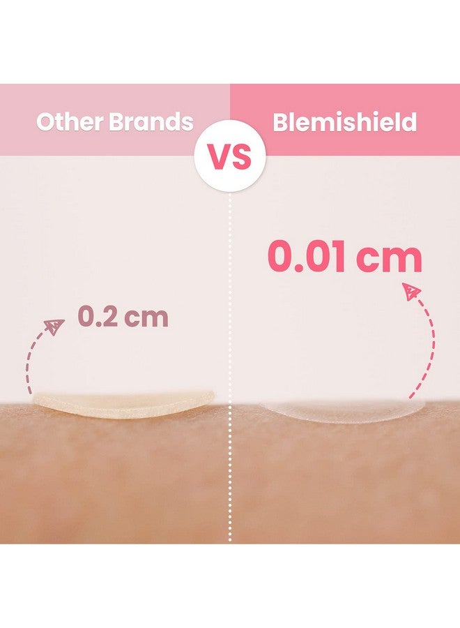 Glam Up Hydrocolloid Blemish Pimple Zit Patches(180Pcs/2Size) Invisible Ultra Thin Spot Cover Stickers For Face And Skin Strong Waterproof And Adhesive Overnight Veganfriendly - Image 3