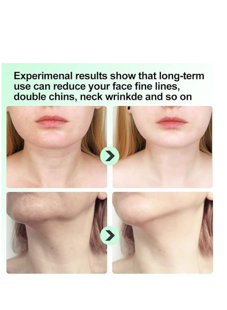 INTENSE Wrinkle Removal Face Massager, Double Chin Reducer Skin Care Devicer for Facial and Neck with 3 Color Modes for Lift, Relieve Fine Lines and Tightening Sagging Skin (White) - Image 5