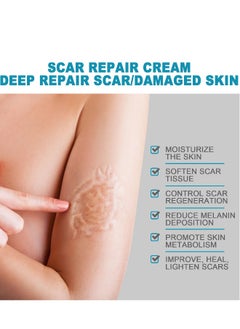 West&Month Scar Repair Cream Dilute Hyperplasia Pregnancy Surgery Burn Scald Skin Repair Scar Cream 20g  - Image 3