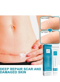 West&Month Scar Repair Cream Dilute Hyperplasia Pregnancy Surgery Burn Scald Skin Repair Scar Cream 20g  - Image 5