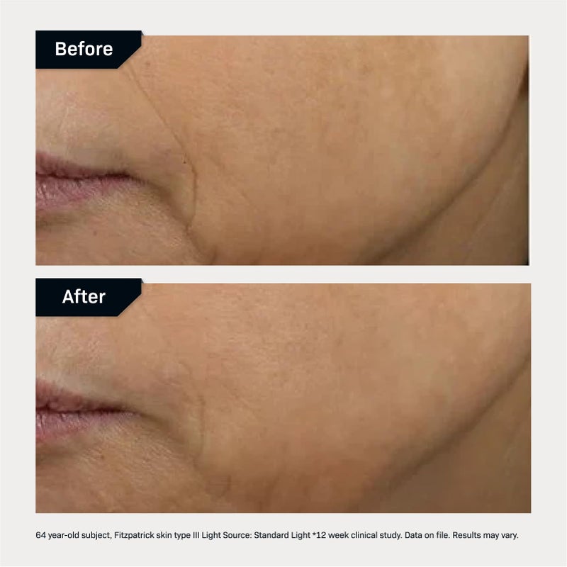 Revision Skincare DÂ·EÂ·J Face CreamÂ®, Advanced Anti Aging Moisturizer, Lifting and Firming, Antioxidant Rich, 0.5 oz - Image 5