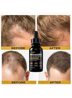 LUNOON 5% Minoxidil Hair Growth Serum for Men, Men Beard Growth with Biotin and Minoxidil Extract Serum for Hair Loss, Thinning and Faster Regrowth Treatment  - Image 3