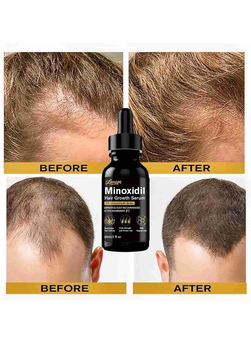 LUNOON 5% Minoxidil Hair Growth Serum for Men, Men Beard Growth with Biotin and Minoxidil Extract Serum for Hair Loss, Thinning and Faster Regrowth Treatment - Image 3