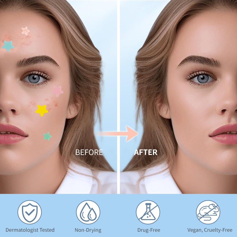 QUSTERE Pimple Patches for Face, Colorful Hydrocolloid Acne Patches, Cute Star Zit Covers for Face, Spot Stickers with Tea Tree, Salicylic Acid & Cica Oil| 4 Sizes (8mm, 10mm, 12mm & 14mm) |357 Count - Image 4