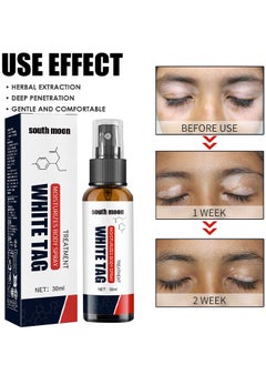 SOUTH MOON White Tag Moisturizes Body Spray, Skin Repair Spray, Promote Melanin Recovery, Reduces White Spots On Skin And Improve Skin Pigmentation, Vitiligo Care Spray 30ML  - Image 3