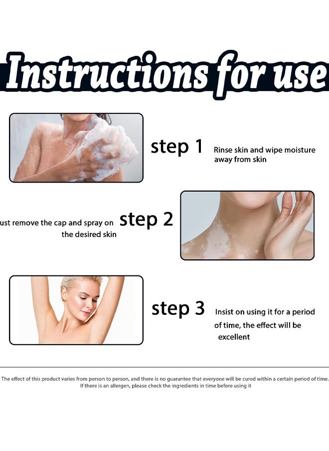 SOUTH MOON - White Tag Moisturizes Body Spray, Skin Repair Spray, Promote Melanin Recovery, Reduces White Spots On Skin And Improve Skin Pigmentation, Vitiligo Care Spray 30ML - Image 1
