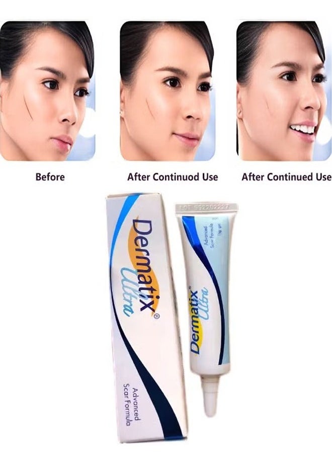 Dermatix - Advanced Scar Gel 15g For Cosmetic Improvement of Scars, Fast Drying and Unique Silicone Gel Formulation, Used For Treatment of Keloids, Surgical and Hypertrophic Scars, Suitable For Sensitive Skin - Image 1