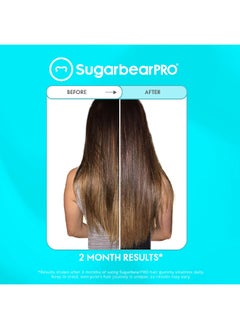 SugarbearPRO Sugarbear Hair Vitamin Gummy 6 Month Supply Extra Strength Biotin 6000mcg, Growth for Men & Women, Vegan Vitamin B12, MSM, Inositol, Omega 3, Elderberry, Certified Kosher, Halal, Cruelty-Free  - Image 2