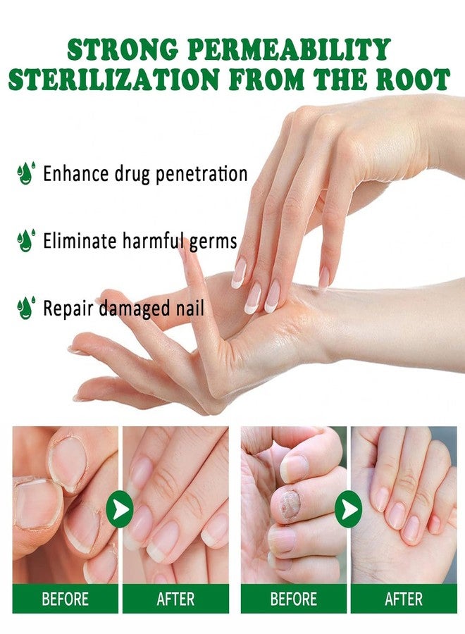 Maginno Nail Fungus Treatment Gel for Toenail & Fingernail Repair - Fast Absorbing Antifungal Nail Cream - Thick & Damaged Nails - Intensive Fungal Nail Care Solution for Men & Women - Image 5