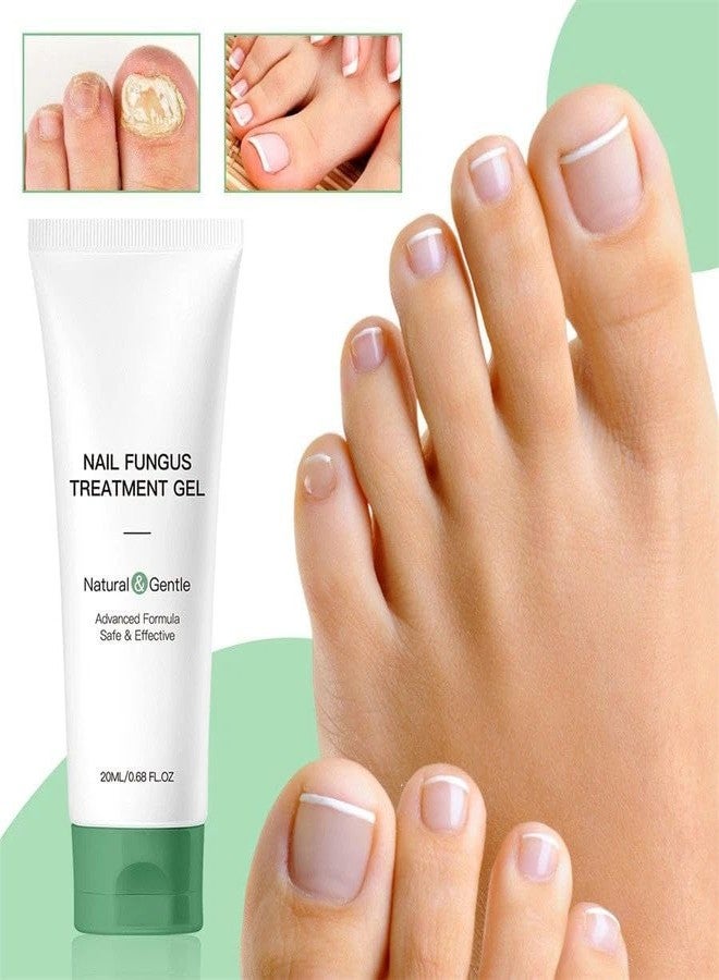 Maginno Nail Fungus Treatment Gel for Toenail & Fingernail Repair - Fast Absorbing Antifungal Nail Cream - Thick & Damaged Nails - Intensive Fungal Nail Care Solution for Men & Women - Image 2