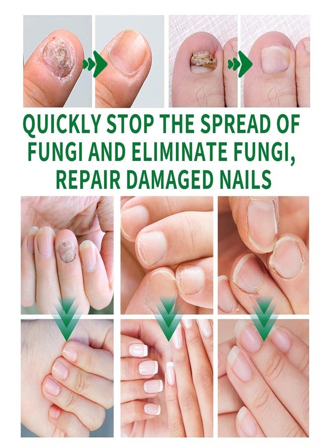Maginno Nail Fungus Treatment Gel for Toenail & Fingernail Repair - Fast Absorbing Antifungal Nail Cream - Thick & Damaged Nails - Intensive Fungal Nail Care Solution for Men & Women - Image 4