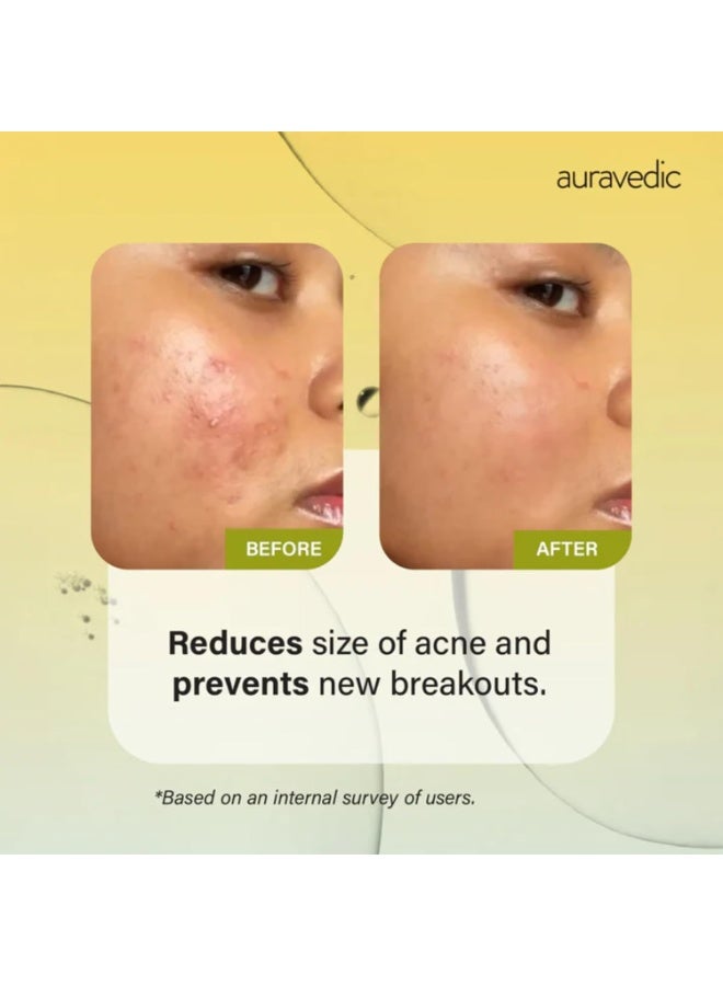 Auravedic tea tree serum,2% salicylic Acid,niacinamide,zinc,30ml - Image 4