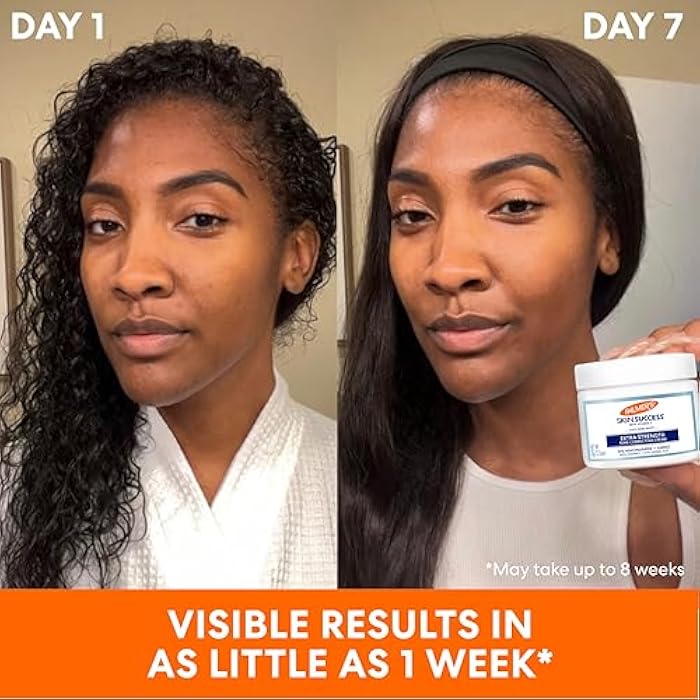 Palmer's Skin Success Extra Strength Tone Correcting Face Cream, 2.7 Fl Oz, Dark Spot Corrector for Discoloration, Age Spots and Post-Acne Marks - Image 5