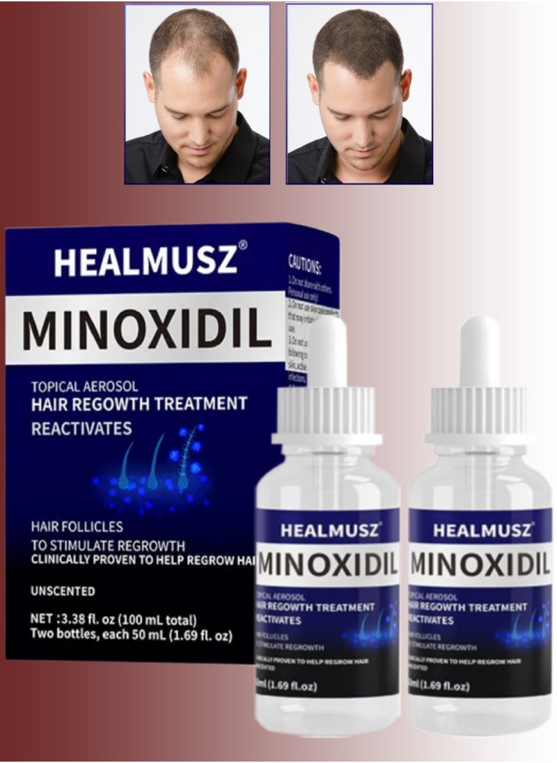 HEALMUSZ - 2Pcs Minoxidil Hair Growth Treatment Reactivate Hair and Beard Follicles for Hair Growth Men and Women Minoxidil Solution Serums 5% Minoxidil Hair Regrowth Treatment Serum 2x50ml - Image 1