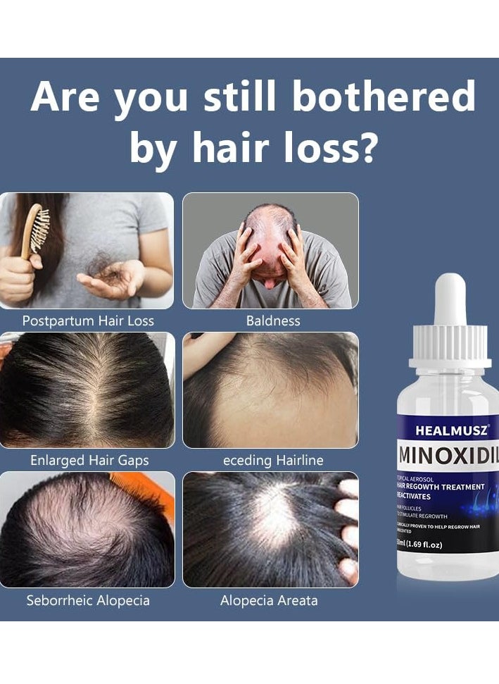 HEALMUSZ - 2Pcs Minoxidil Hair Growth Treatment Reactivate Hair and Beard Follicles for Hair Growth Men and Women Minoxidil Solution Serums 5% Minoxidil Hair Regrowth Treatment Serum 2x50ml - Image 1