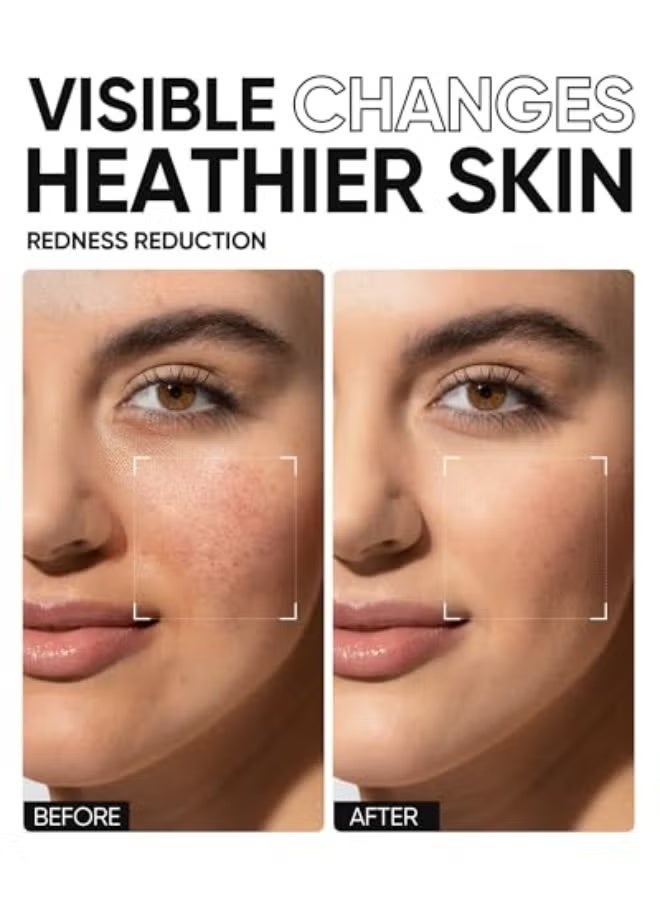 SKINTIFIC 5X Ceramide Barrier Moisturizer Gel | Hyaluronic Acid, Centella , Marine Collagen | Face Moisturizer for All Skin | Facial Creams with Hyaluronic Acid and 5X Ceramides | Hydrating Moisturizer | Fragrance Free Non-Comedogenic - Image 4