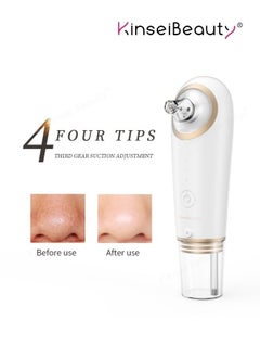 KinseiBeauty Facial Pore Blackhead Remover Vacuum – Deep Cleansing Pore Extractor with 3 Suction Levels, 4 Probes & USB Rechargeable Design – Professional Blackhead Removal Tool for Women & Men  - Image 1