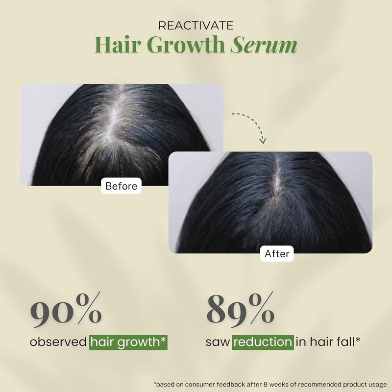 little extra Reactivate Hair Growth Serum With 2 Rosemary Anagain Redensyl Procapil And Baicapil 30Ml Bottle For All Hair Types 100 Grams - Image 4