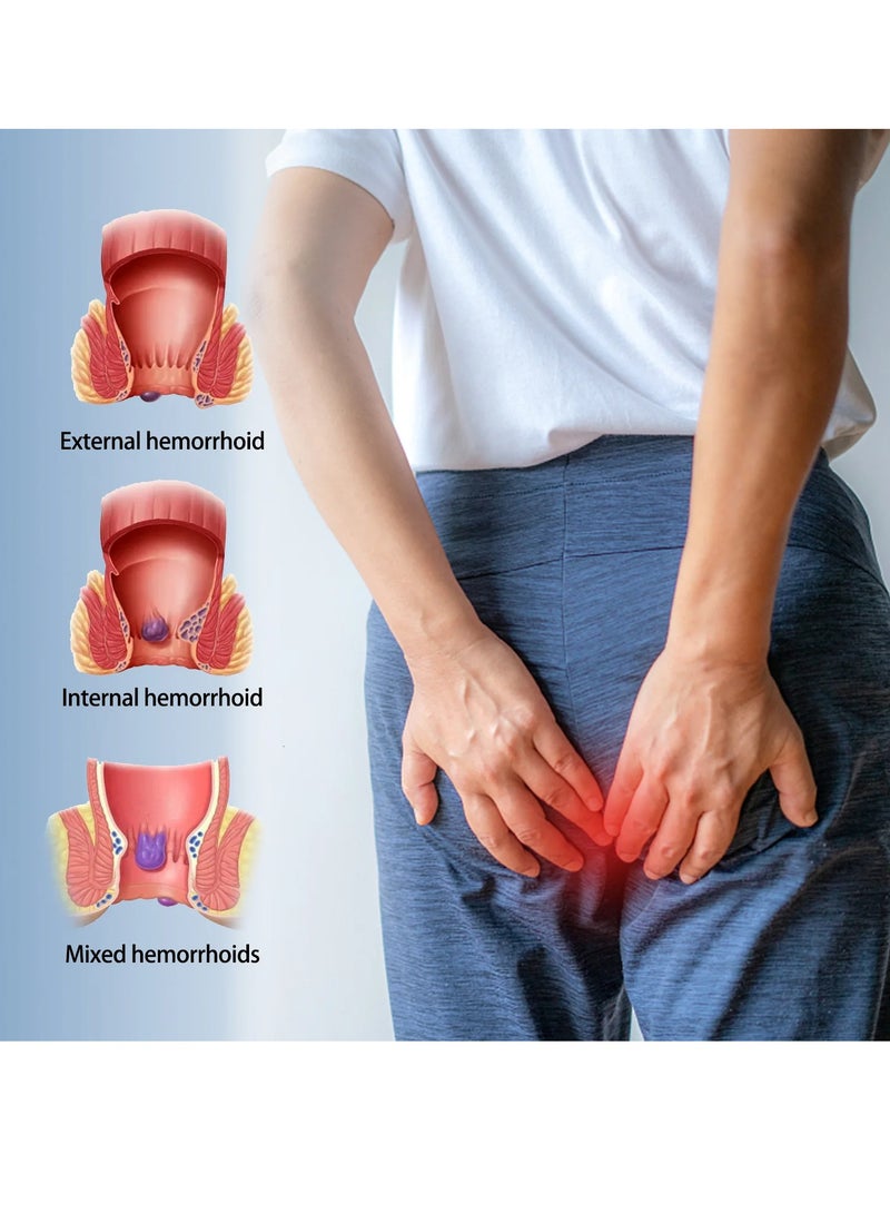 SOUTH MOON Piles Pain Relief Cream, Herbal Mild Healthcare Cream, Pain Reducing Hips Fissure Therapy Ointment, Safe Gentle Swelling Break Hemorrhoid Cream For Cure Swelling Bleeding  - Image 3