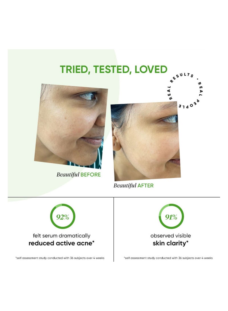 Dot & Key 2% Salicylic Acid + Cica Anti Acne Serum with Zinc | Salicylic Acid Serum for Acne and Dark Spots | Serum for Oily Acne Prone Skin & Sensitive Skin | 20 ml