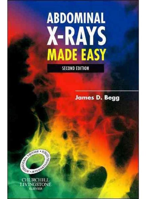 Abdominal X-Rays Made Easy