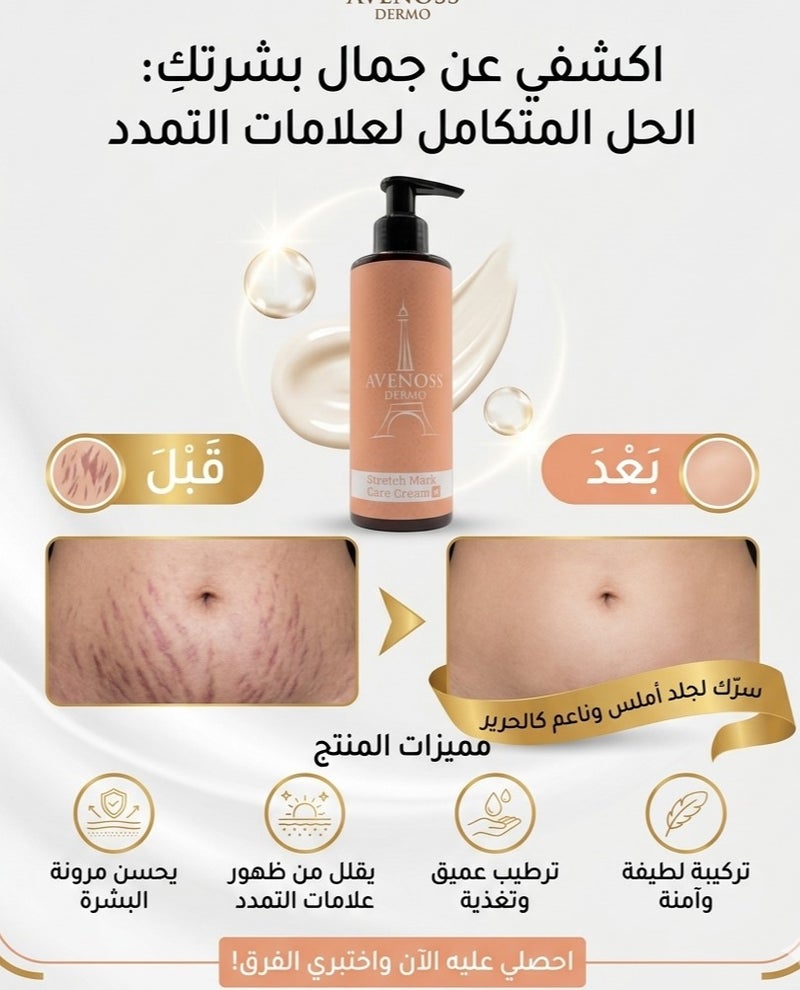 Avenoss Dermo – Stretch Mark Care Cream (200ml) - Image 2
