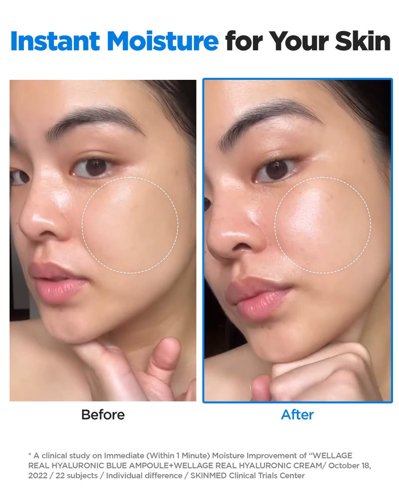 Wellage أمبولة ويللاج الحقيقية من حمض الهيالورونيك الأزرق 100، سيروم كوري، أمبولة حمض الهيالورونيك خالية من العطور مع بانثينول، يام بري، سنتيلا للبشرة الحساسة والجافة مرطب 2.54 أونصة سائلة - Image 3