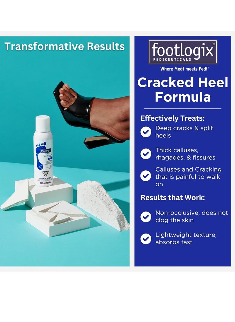 Footlogix - FOOTLOGIX Cracked Heel Formula, White 4.23 Ounce - Image 1
