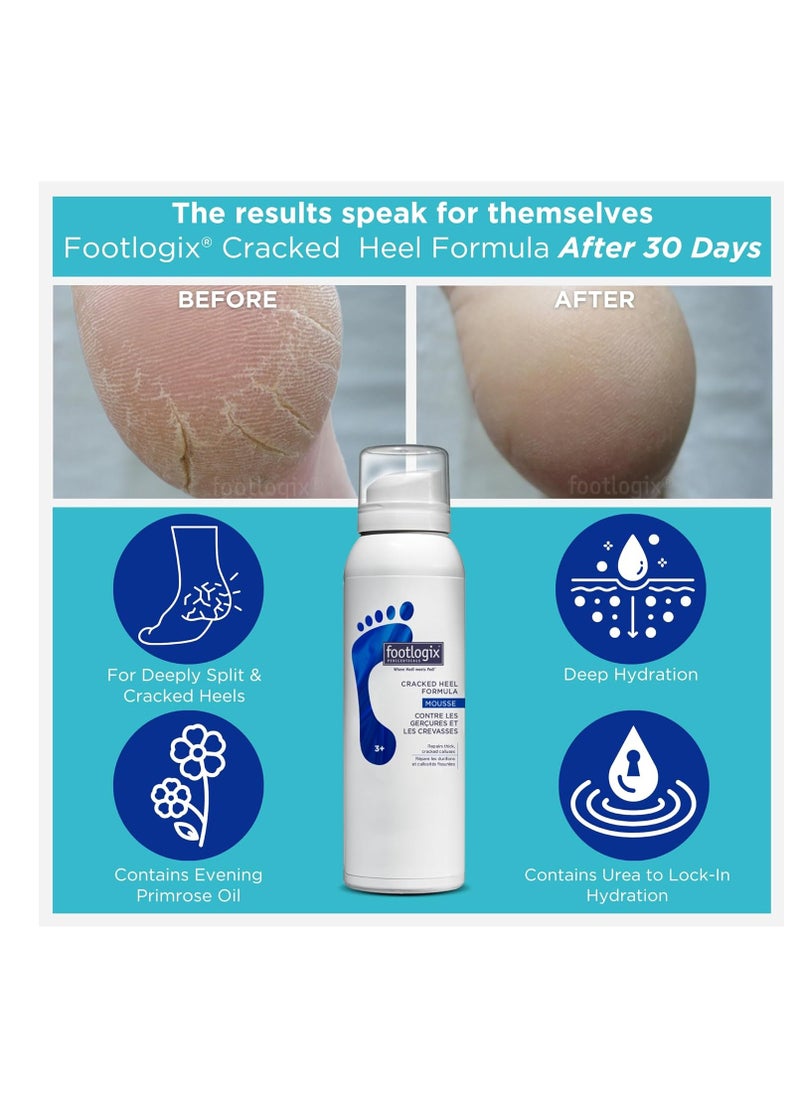 Footlogix - FOOTLOGIX Cracked Heel Formula, White 4.23 Ounce - Image 1