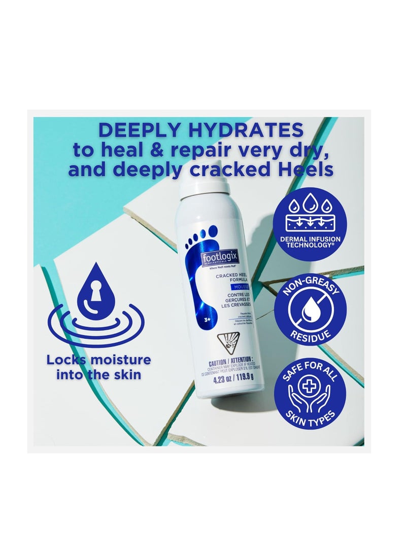 Footlogix - FOOTLOGIX Cracked Heel Formula, White 4.23 Ounce - Image 1